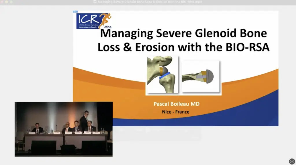 Managing Severe Glenoid Bone Loss & Erosion with the BIO-RSA