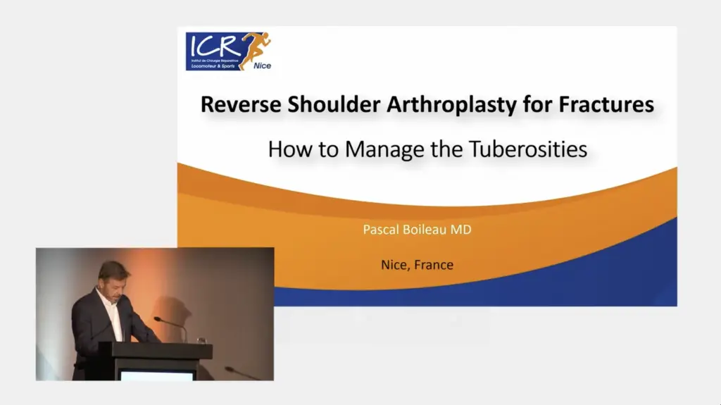 Reverse Shoulder Arthroplasty for Fractures - How to Manage the Tuberosities
