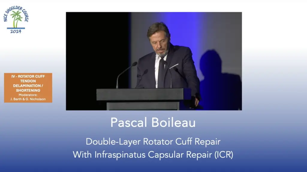 Double-Layer Rotator Cuff Repair With Infraspinatus Capsular Repair (ICR)