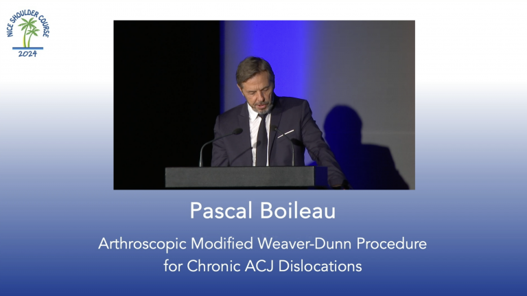 Arthroscopic Modified Weaver-Dunn Procedure for Chronic ACJ Dislocations