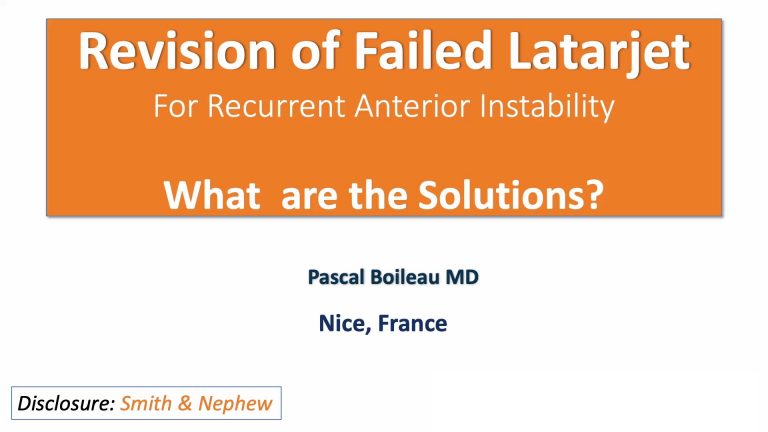 Revision of Failed Latarjet for Recurrent Anterior Instability