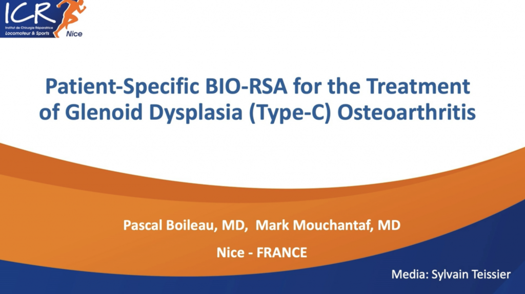 Patient-Specific BIO-RSA for the Treatment of Glenoid Dysplasia (Type-C) Osteoarthritis