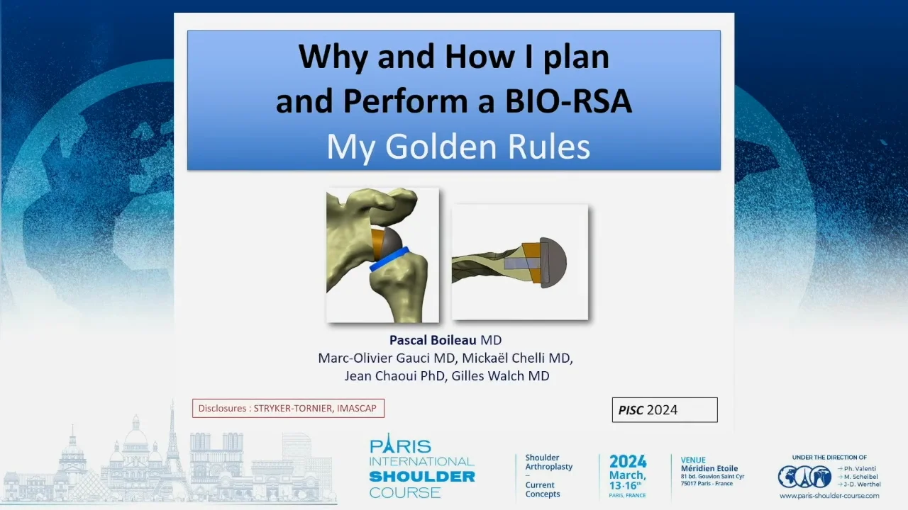 Why and How I plan and Perform a BIO-RSA - Nice Shoulder TV